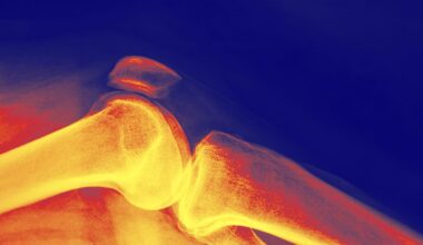 This Is The Best Diet For Stronger Bones During Weight Loss, Per Research