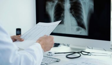 Lysine Improves Survival in Acute Lung Injury Models