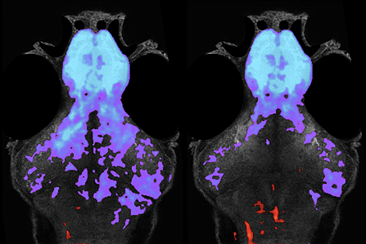 Infant Brain Imaging Study findings, and more