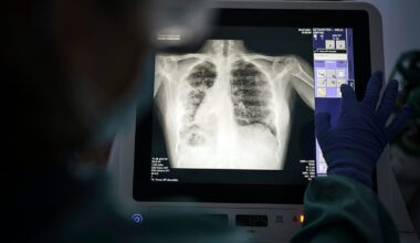 Europe misses 1 out of 5 tuberculosis cases as drug resistance rises, health agencies warn