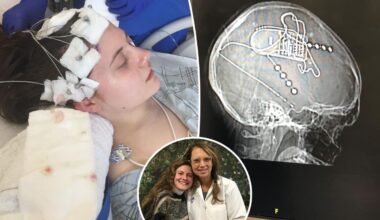 My 'panic attacks' turned out to be much more serious — I needed brain surgery