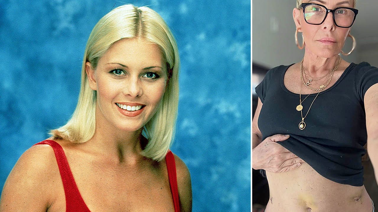 'Baywatch' star Nicole Eggert reveals new cancer signs, gets hysterectomy