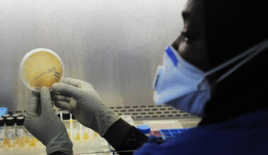 Undetected Tuberculosis Crisis Plagues Europe; WHO Rolls Out New Diagnostic Tools