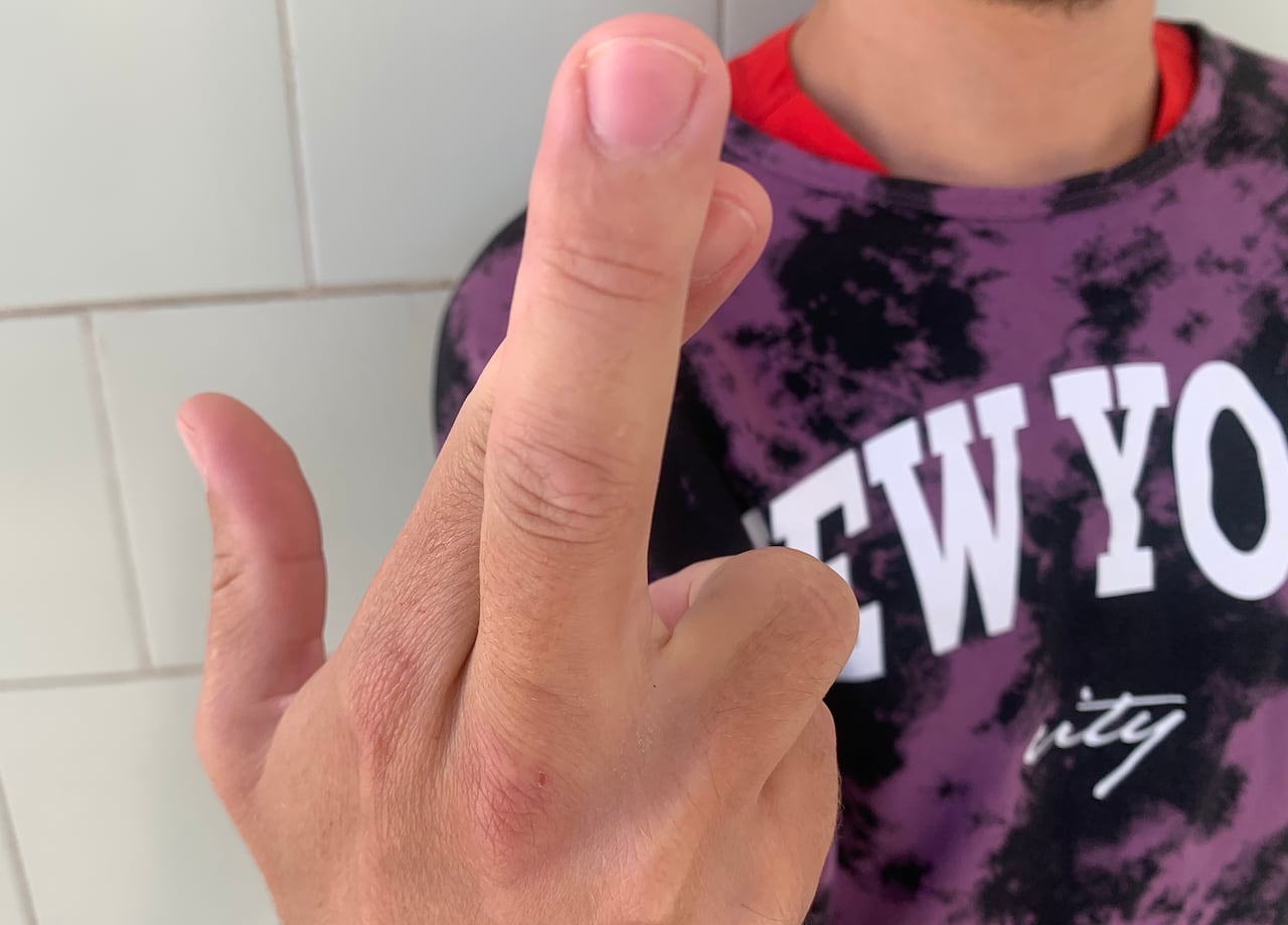 a hand with two fingers crossed 