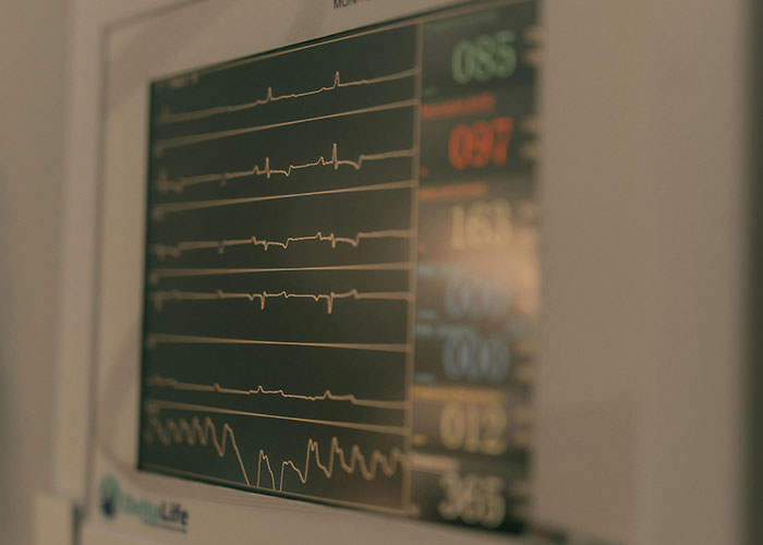 Medical monitor displaying heart rhythms and vital signs, illustrating medical secrets so dark you might be scared to visit again.