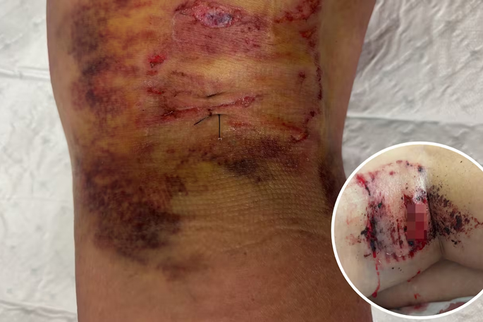 SunLive - Mount woman left traumatised after dog mauling