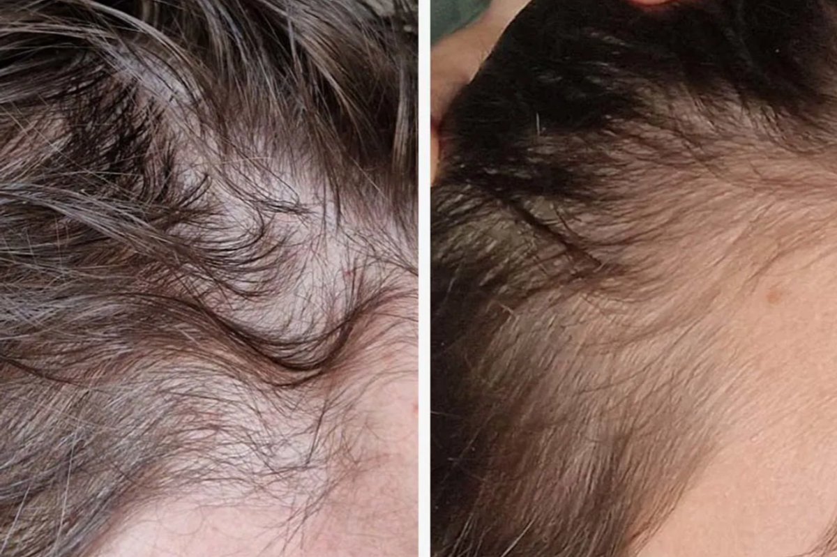 Users have been praising DR VEGAN's Hair Saviour saying their hair is in 'better condition' after use