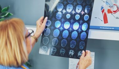 HDC: Hospital’s missed referral criticised after woman’s death from severe brain bleed