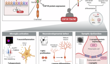 CSF1R T567M mutation induces microglial dysfunction and synaptic impairment in patient iPSC-derived cerebral organoids of CSF1R-related disorder