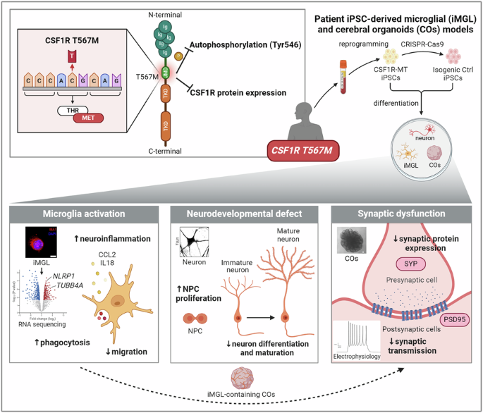 CSF1R T567M mutation induces microglial dysfunction and synaptic impairment in patient iPSC-derived cerebral organoids of CSF1R-related disorder