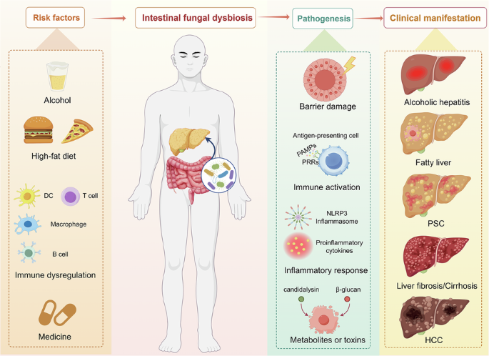 The role and possible mechanism of intestinal fungi in the progression of chronic liver diseases