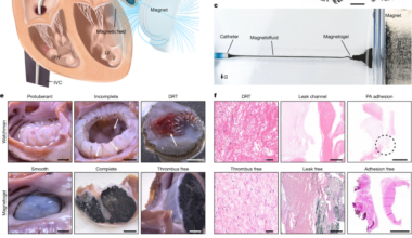 Long-term thrombus-free left atrial appendage occlusion via magnetofluids