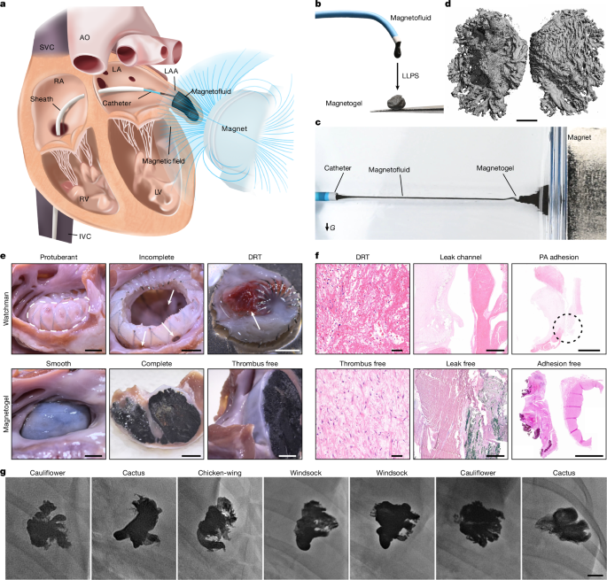 Long-term thrombus-free left atrial appendage occlusion via magnetofluids