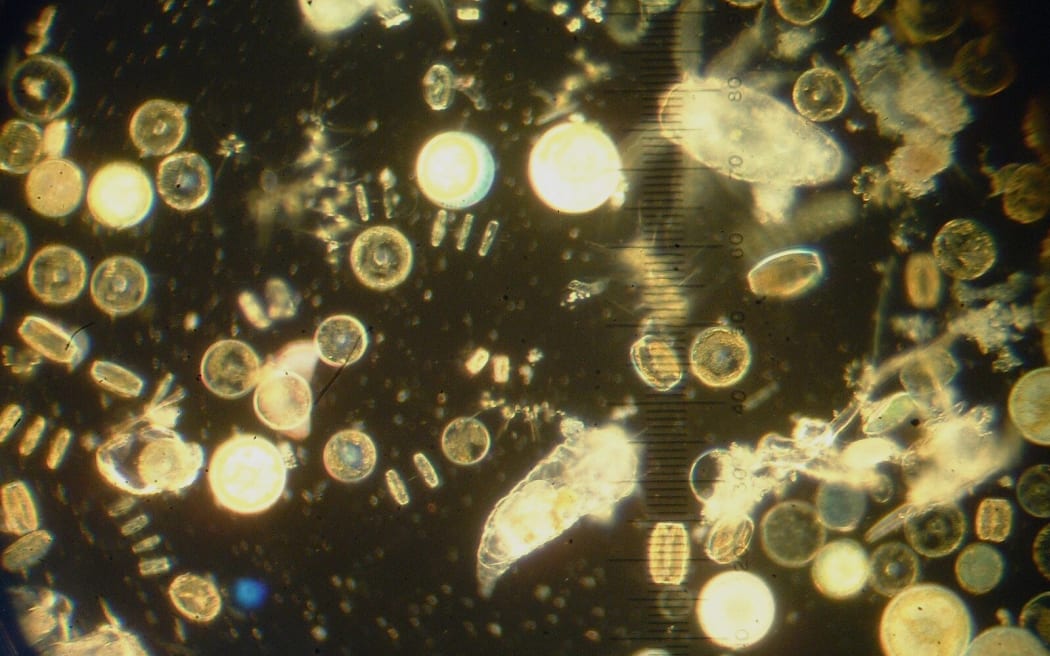 Image showing a cluster of brightly-light phytoplankton against a dark background, as seen under a microscope.