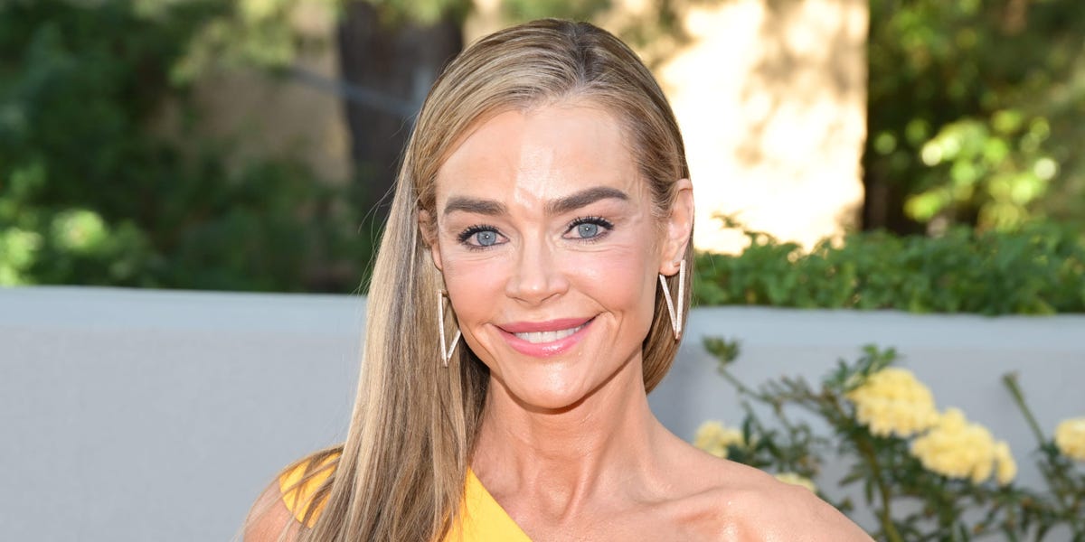 Facelifts Aren't Embarrassing Anymore, and Denise Richards Is Proof