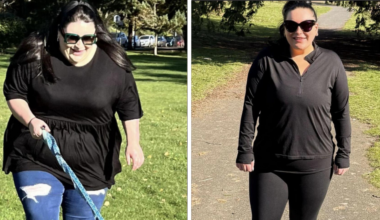 'Weight-loss jabs helped my polycystic ovaries'