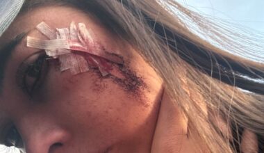 Students injured in Christchurch by bottles thrown by neighbouring house party