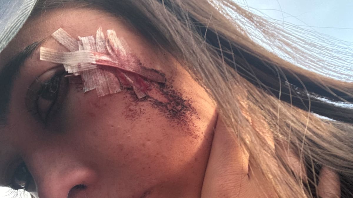 Students injured in Christchurch by bottles thrown by neighbouring house party