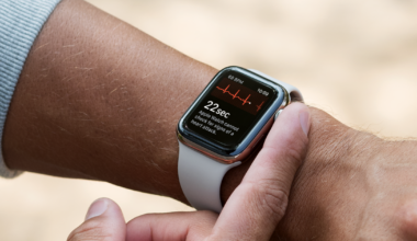 Apple Watch leaves user with burn scar, support case drags on for months