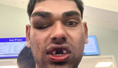 Auckland Papakura ‘road rage’: Man pulled from car and stomped on at railway crossing