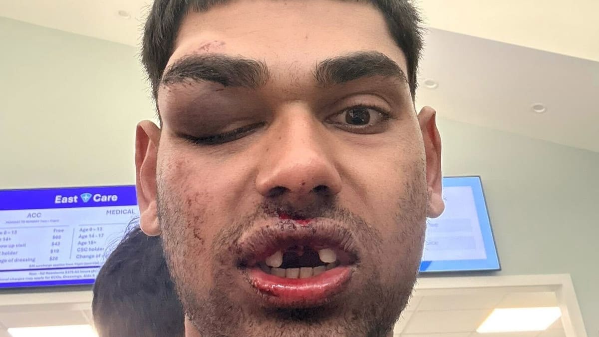 Auckland Papakura ‘road rage’: Man pulled from car and stomped on at railway crossing