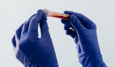 Women in Space Could Face a Hidden Blood-Clot Risk, Study Suggests : ScienceAlert