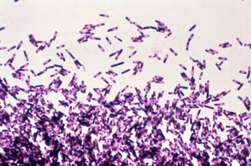 Clostridium difficile photomicrograph