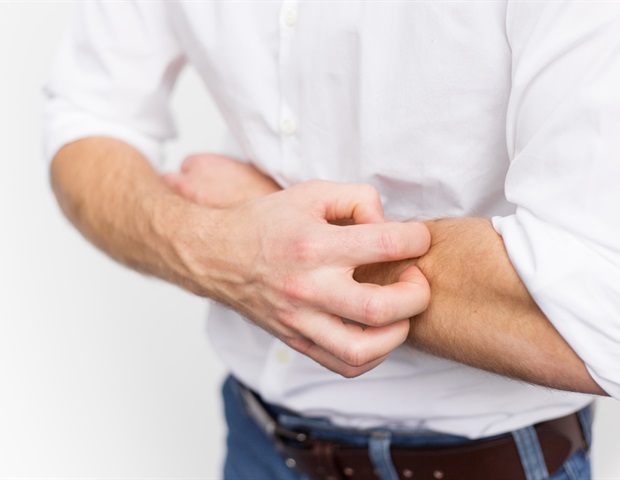 Math-based model helps optimize treatment for chronic eczema