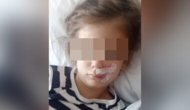 SunLive - 'Vicious' dog attack leaves 6yo scarred for life