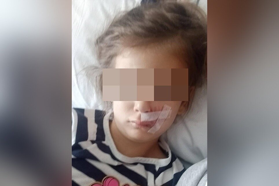 SunLive - 'Vicious' dog attack leaves 6yo scarred for life