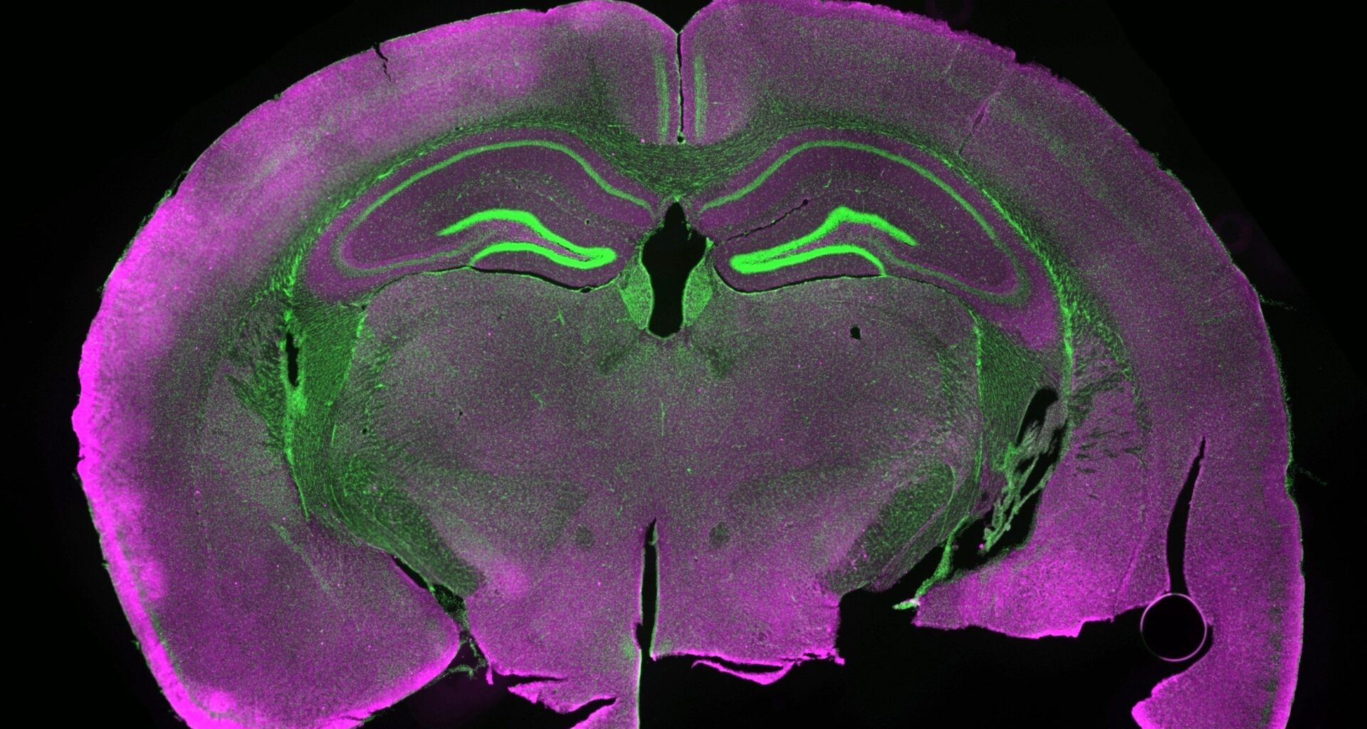 Frozen mouse brains show signs of life after thawing