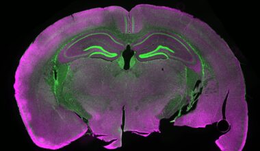 Frozen mouse brains show signs of life after thawing