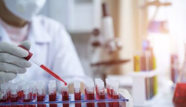 AI shifts non-communicable disease risk prediction beyond genetics