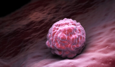 New Pharmac proposal looks to stem post-cell transplant complications