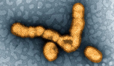 Swine flu, ketamine and depression, football CTE: Morning Rounds