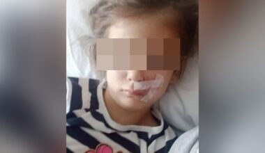 No destruction for Rotorua dog that bit a child’s face in Tauranga