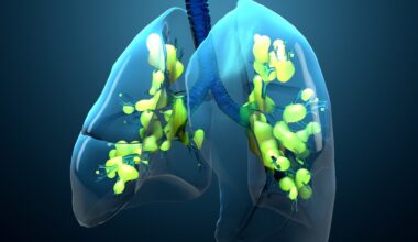 Study: Four year mortality and quality of life after ICU treatment for COVID 19 related acute respiratory distress syndrome. Image Credit: Design_Cells / Shutterstock