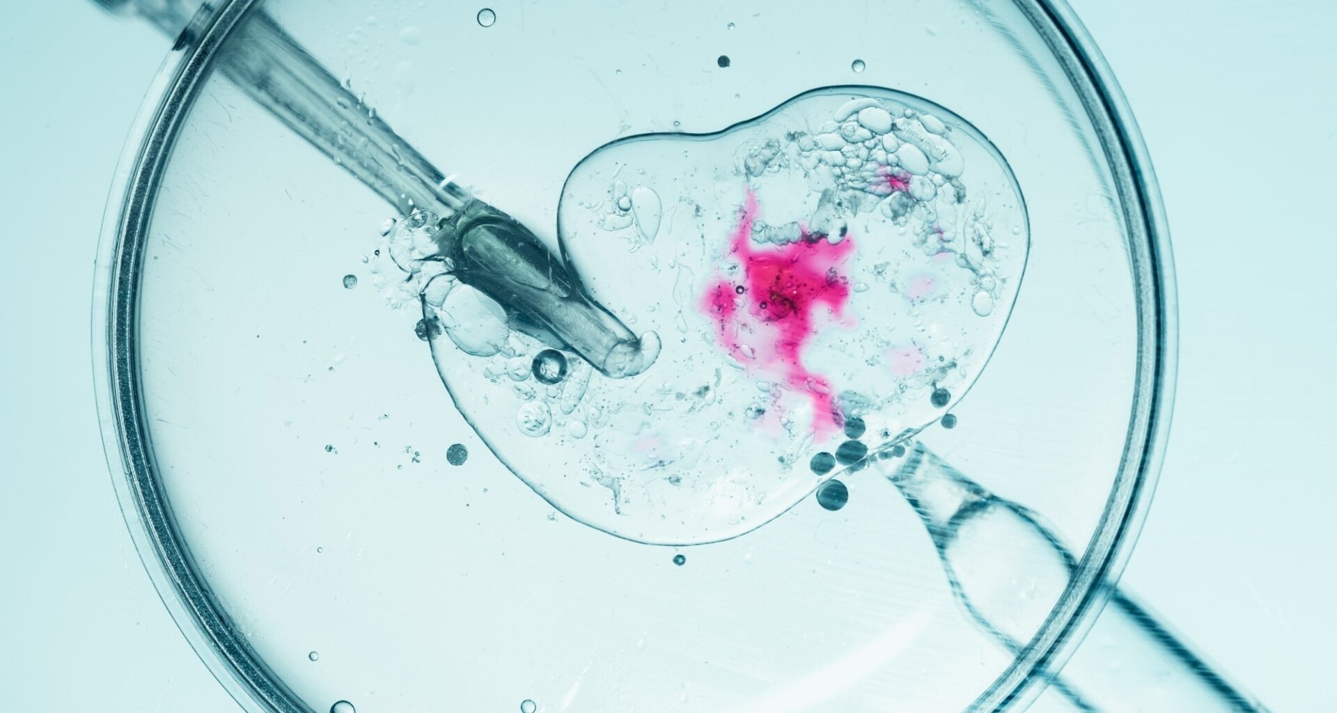 Microscopic view of in vitro fertilization procedure