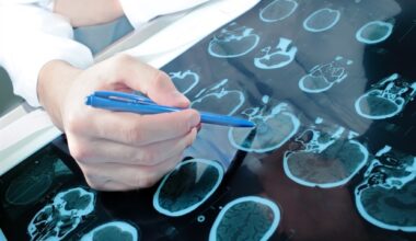 Spiritual care should be routine for patients with neurological diseases