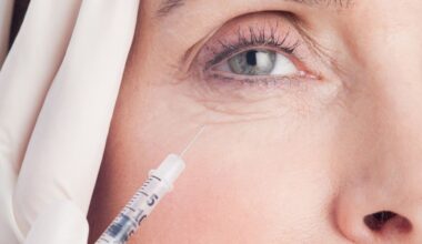 Sunekos, Reviewed: This Injectable Moisturiser Tweakment Is Said To Hydrate, Plump & Smooth. Here’s What It Did For Me