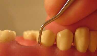 Snus linked to gum damage but tooth decay risk unclear