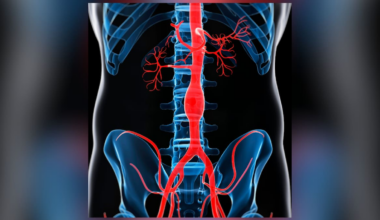 Abdominal aortic aneurysm survivor: ‘Hundreds of NZers deserve the chance at a future that I’ve been given’