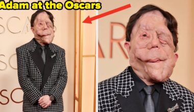 After A Comedian Made Fun Of His Appearance At The Oscars, Adam Pearson Responded Perfectly - BuzzFeed