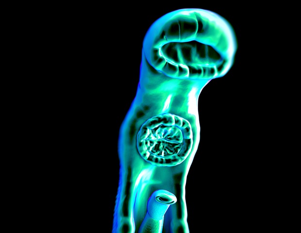 Precision mapping identifies household hotspots of schistosomiasis