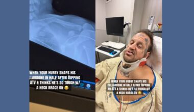 Jelly Roll reveals ATV crash left him with broken collarbone before Grammys