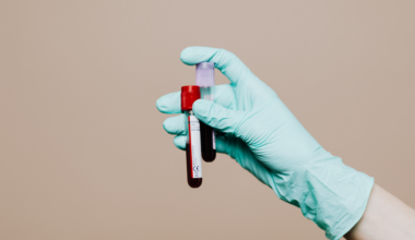 #hauora: Experts Warn Against Complacency as New COVID-19 Wave Spreads Across Aotearoa – Waatea News: Māori Radio Station