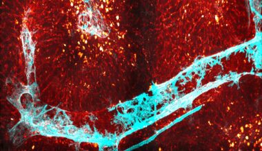 New compound stops common complications after intestinal surgery – WashU Medicine