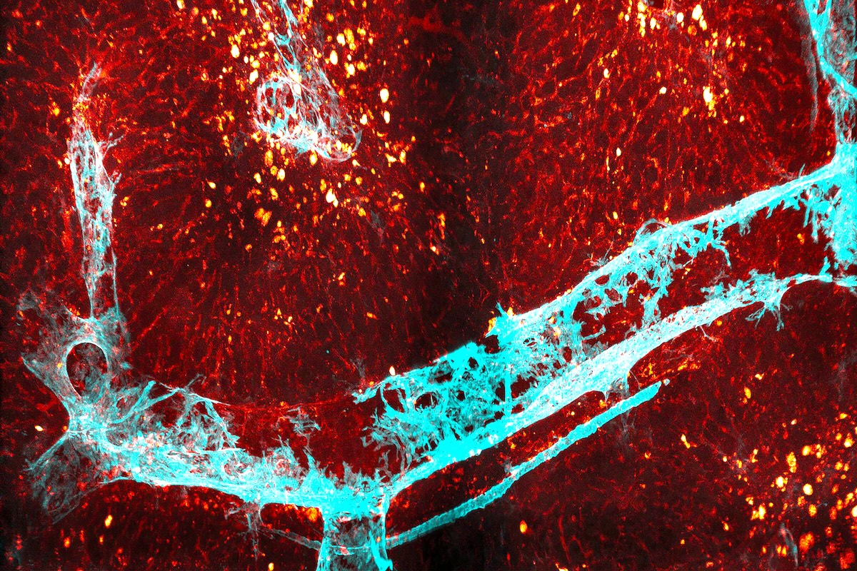 New compound stops common complications after intestinal surgery – WashU Medicine