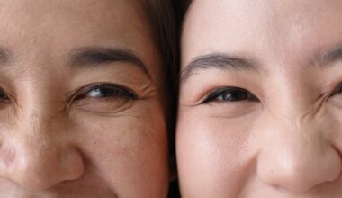 New peptide serum shown to reduce both dynamic and static wrinkles