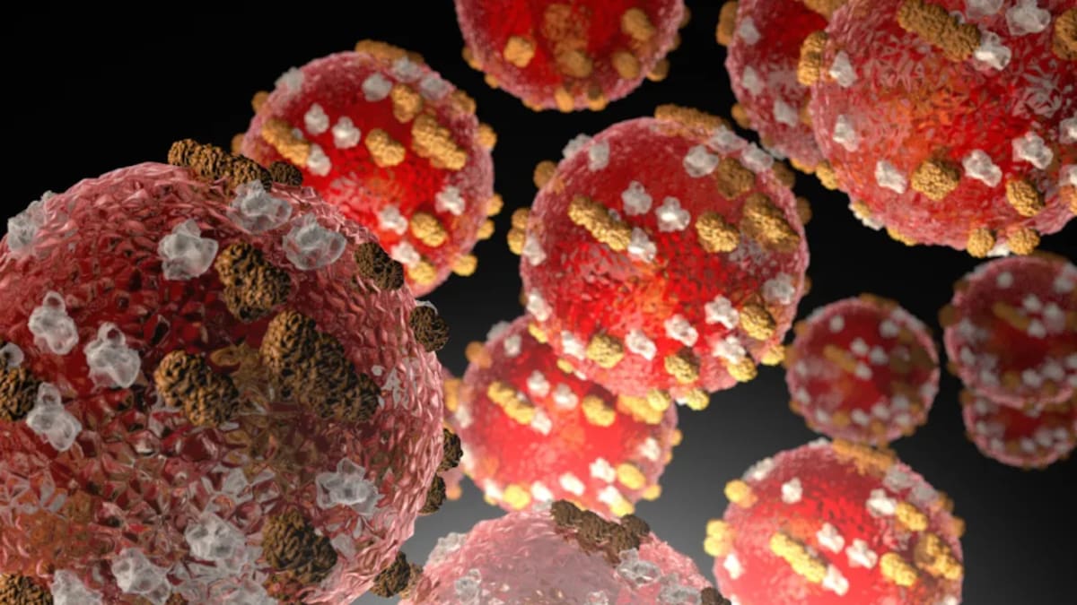 Auckland Airport measles alert: International terminal named exposure site